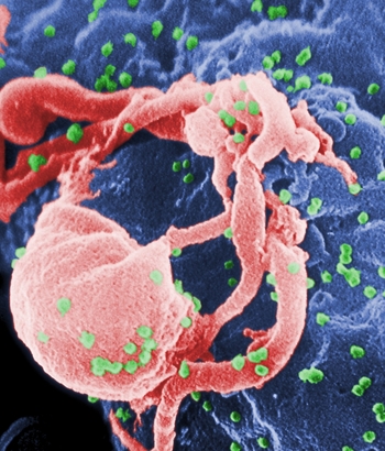 Shpresa për shërim! Shkencëtarët “presin” HIV nga qelizat 